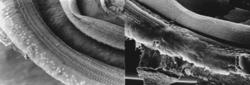 Healthy (left) and noise damaged (right) cochlear hair cells